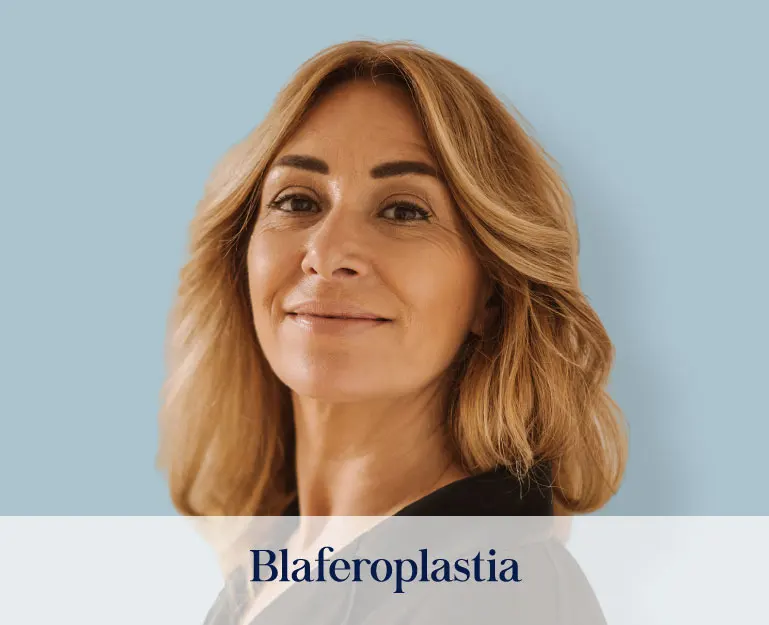 blefaroplastia-1