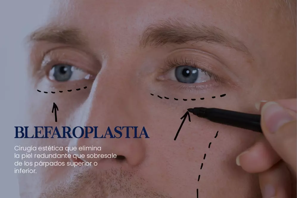 medidas-fotos-blefaroplastia