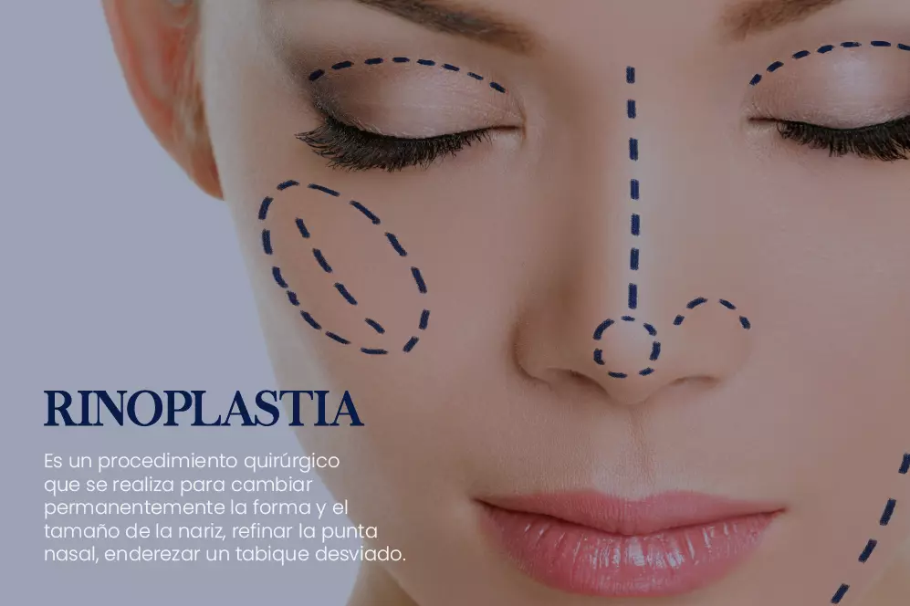 medidas-fotos-rinoplastia